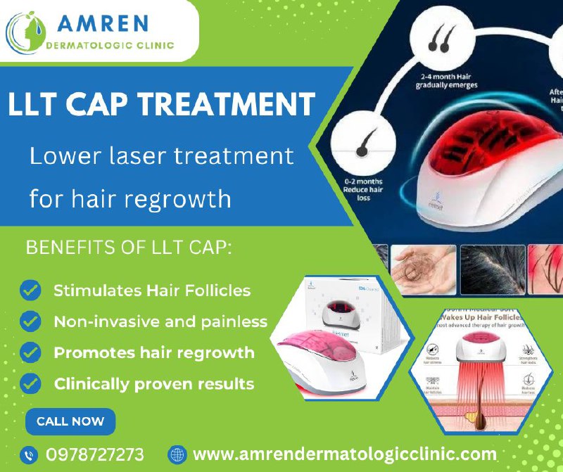 LLT CAP TREATMENT